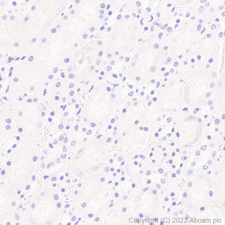 Immunohistochemistry (Formalin/PFA-fixed paraffin-embedded sections) - Anti-GPCR GPRC5D antibody [EPR28376-41] (AB315808)
