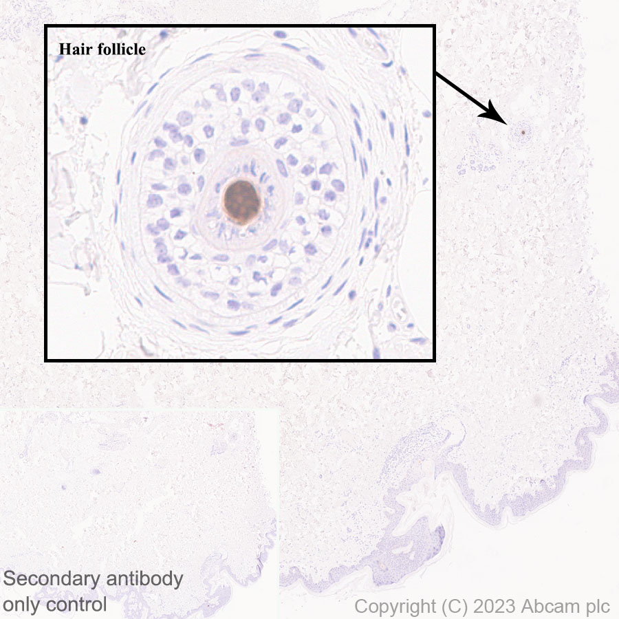Immunohistochemistry (Formalin/PFA-fixed paraffin-embedded sections) - Anti-GPCR GPRC5D antibody [EPR28376-41] - BSA and Azide free (AB315809), expandable thumbnail