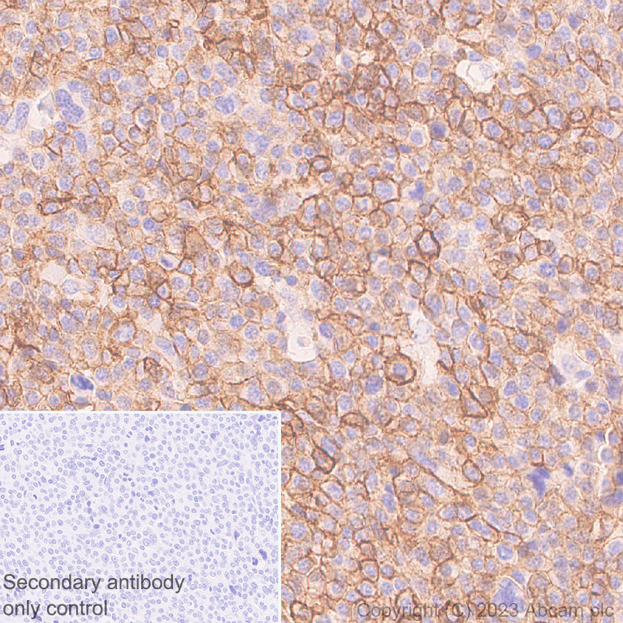 Immunohistochemistry (Formalin/PFA-fixed paraffin-embedded sections) - Anti-GPCR GPRC5D antibody [EPR28376-41] - BSA and Azide free (AB315809), expandable thumbnail