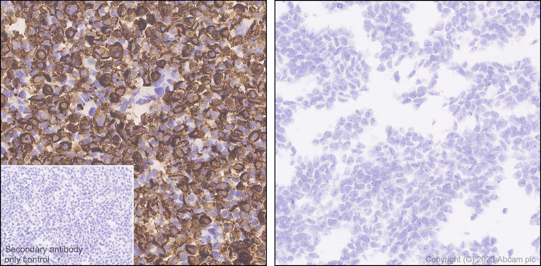Immunohistochemistry (Formalin/PFA-fixed paraffin-embedded sections) - Anti-GPCR GPRC5D antibody [EPR28376-41] - BSA and Azide free (ab315809), expandable thumbnail