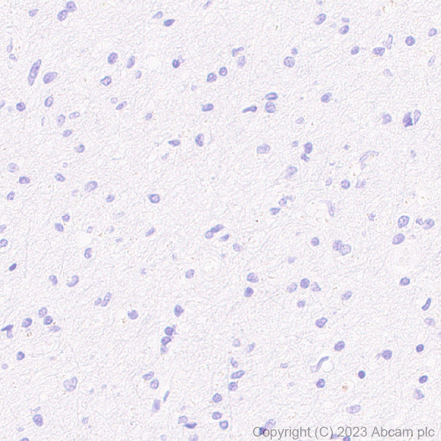 Immunohistochemistry (Formalin/PFA-fixed paraffin-embedded sections) - Anti-GPCR GPRC5D antibody [EPR28376-41] - BSA and Azide free (ab315809), expandable thumbnail
