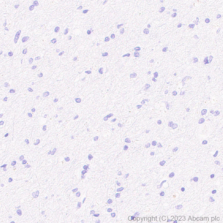 Immunohistochemistry (Formalin/PFA-fixed paraffin-embedded sections) - Anti-GPCR GPRC5D antibody [EPR28376-41] - BSA and Azide free (AB315809)