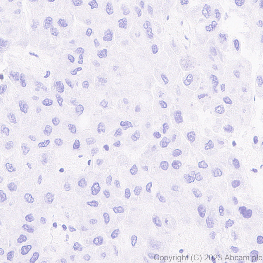Immunohistochemistry (Formalin/PFA-fixed paraffin-embedded sections) - Anti-GPCR GPRC5D antibody [EPR28376-41] - BSA and Azide free (ab315809), expandable thumbnail