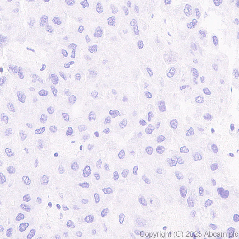 Immunohistochemistry (Formalin/PFA-fixed paraffin-embedded sections) - Anti-GPCR GPRC5D antibody [EPR28376-41] - BSA and Azide free (AB315809)