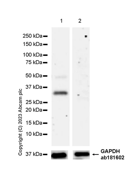 Western blot - Anti-GPCR GPRC5D antibody [EPR28376-41] - BSA and Azide free (AB315809)