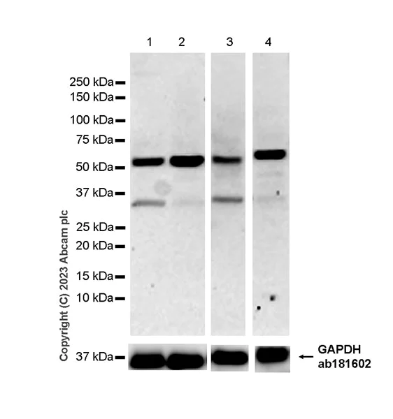 Western blot - Anti-GPCR GPRC5D antibody [EPR28376-41] - BSA and Azide free (AB315809)