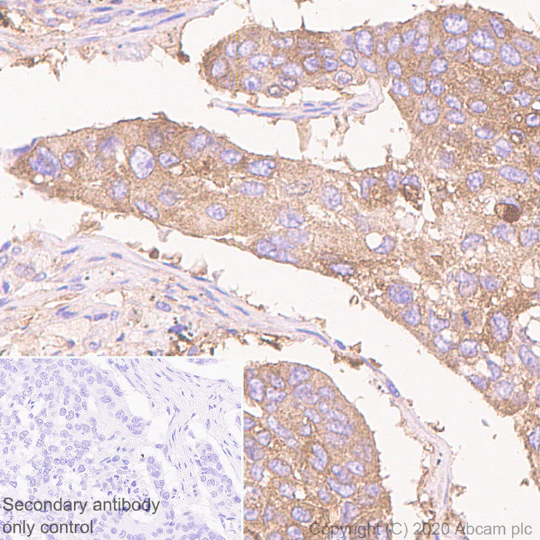 Immunohistochemistry (Formalin/PFA-fixed paraffin-embedded sections) - Anti-GPCR LGR6 antibody [EPR6874] (AB126747)