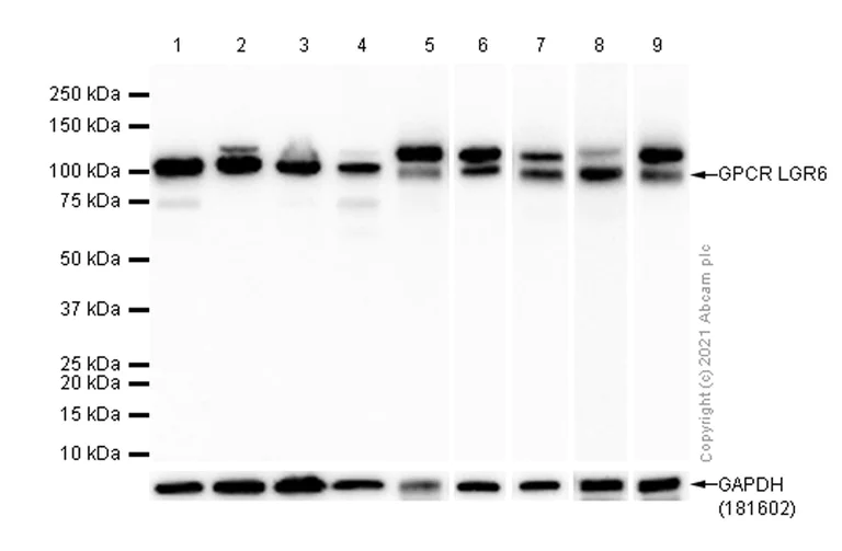 Western blot - Anti-GPCR LGR6 antibody [EPR6874] - BSA and Azide free (AB240030)