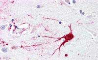 Immunohistochemistry (Formalin/PFA-fixed paraffin-embedded sections) - Anti-GPCR LGR6 antibody - N-terminal (AB188961)