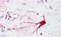 Immunohistochemistry (Formalin/PFA-fixed paraffin-embedded sections) - Anti-GPCR LGR6 antibody - N-terminal (AB188961)