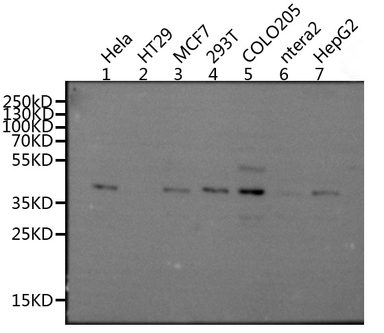 Western blot - Anti-GPCR MRGX2 antibody (AB237047)