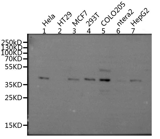 Western blot - Anti-GPCR MRGX2 antibody (AB237047)