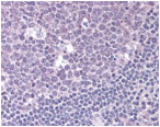 Immunohistochemistry (Formalin/PFA-fixed paraffin-embedded sections) - Anti-GPCR RDC1/CXCR-7 antibody (AB72100)
