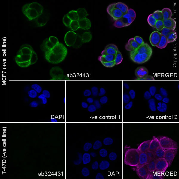 Immunocytochemistry/ Immunofluorescence - Anti-GPCR RDC1/CXCR-7 antibody [EPR29064-191] (AB324431)