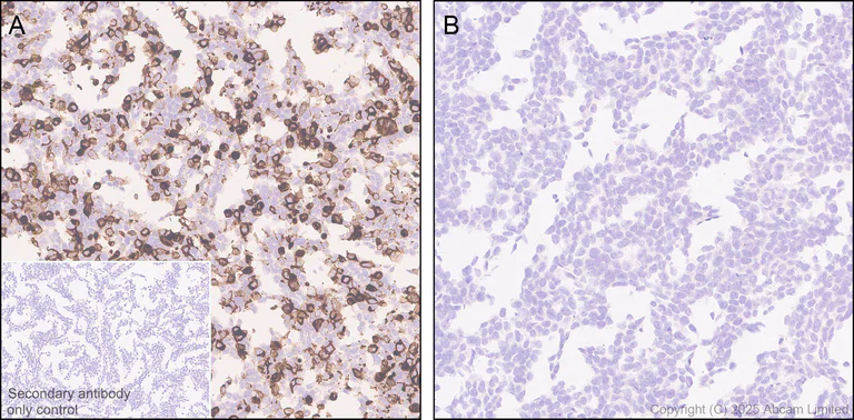 Immunohistochemistry (Formalin/PFA-fixed paraffin-embedded sections) - Anti-GPCR RDC1/CXCR-7 antibody [EPR29064-191] (AB324431)