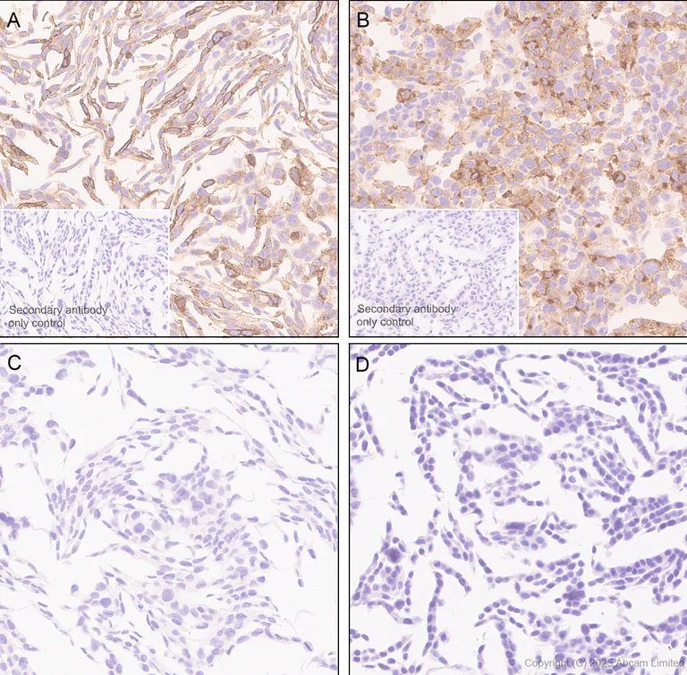 Immunohistochemistry (Formalin/PFA-fixed paraffin-embedded sections) - Anti-GPCR RDC1/CXCR-7 antibody [EPR29064-191] (AB324431)