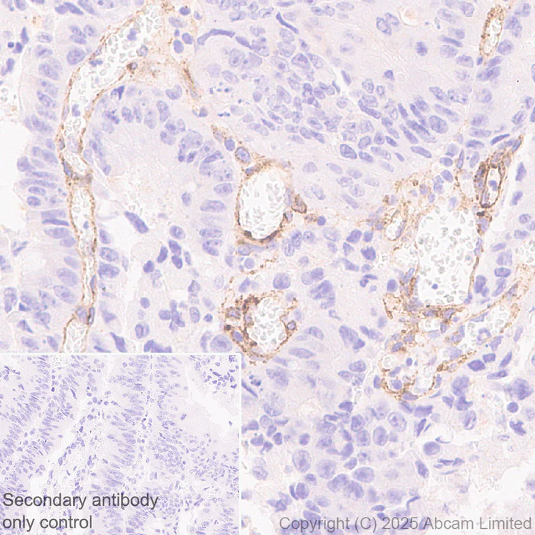 Immunohistochemistry (Formalin/PFA-fixed paraffin-embedded sections) - Anti-GPCR RDC1/CXCR-7 antibody [EPR29064-191] (AB324431)