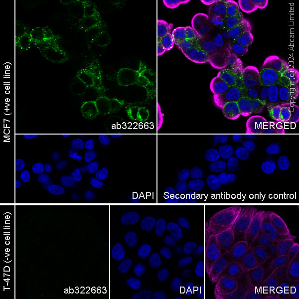 Immunocytochemistry/ Immunofluorescence - Anti-GPCR RDC1/CXCR-7 antibody [EPR29064-22] (AB322663), expandable thumbnail