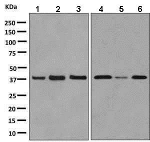 Western blot - Anti-GPCR RDC1/CXCR-7 antibody [EPR9321] (AB138509)