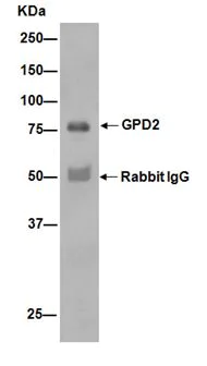 Immunoprecipitation - Anti-GPD2 antibody [EPR14259] - BSA and Azide free (AB240305)