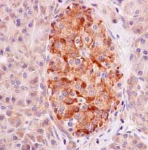 Immunohistochemistry (Formalin/PFA-fixed paraffin-embedded sections) - Anti-GPD2 antibody [EPR14260] (AB182144)