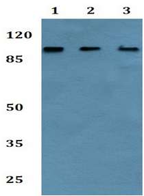 Western blot - Anti-GPI-PLD antibody (AB192543)