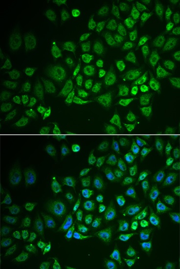 Immunocytochemistry/ Immunofluorescence - Anti-GPI-PLD antibody (AB210753), expandable thumbnail