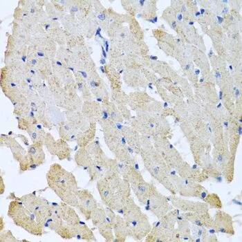 Immunohistochemistry (Formalin/PFA-fixed paraffin-embedded sections) - Anti-GPI-PLD antibody (AB210753)