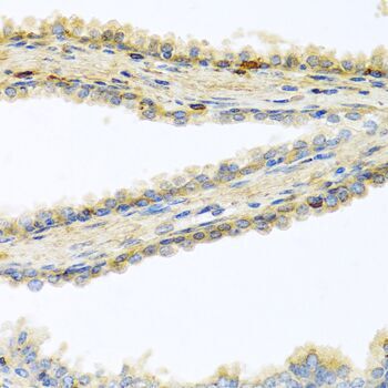 Immunohistochemistry (Formalin/PFA-fixed paraffin-embedded sections) - Anti-GPI-PLD antibody (AB210753), expandable thumbnail
