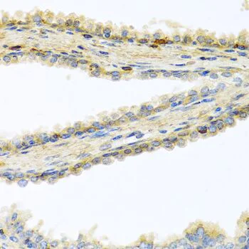 Immunohistochemistry (Formalin/PFA-fixed paraffin-embedded sections) - Anti-GPI-PLD antibody (AB210753)