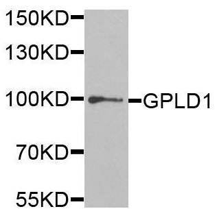Western blot - Anti-GPI-PLD antibody (AB210753), expandable thumbnail
