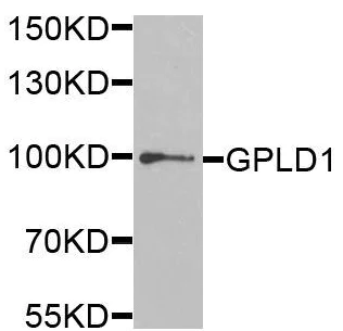 Western blot - Anti-GPI-PLD antibody (AB210753)