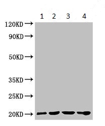Western blot - Anti-Gpihbp1 antibody (AB224728), expandable thumbnail
