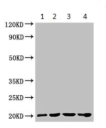 Western blot - Anti-Gpihbp1 antibody (AB224728)