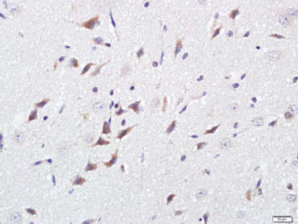 Immunohistochemistry (Formalin/PFA-fixed paraffin-embedded sections) - Anti-GPM6B antibody (AB214459), expandable thumbnail