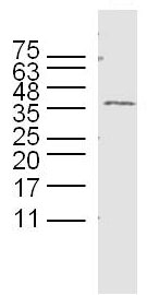 Western blot - Anti-GPM6B antibody (AB214459), expandable thumbnail