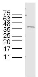 Western blot - Anti-GPM6B antibody (AB214459)