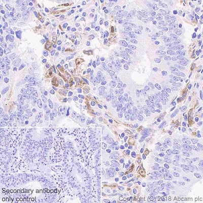 Immunohistochemistry (Formalin/PFA-fixed paraffin-embedded sections) - Anti-GPNMB antibody [EPR22011-11] (AB222109), expandable thumbnail