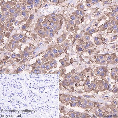 Immunohistochemistry (Formalin/PFA-fixed paraffin-embedded sections) - Anti-GPNMB antibody [EPR22011-11] (AB222109), expandable thumbnail