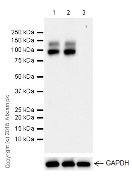 Western blot - Anti-GPNMB antibody [EPR22011-11] (AB222109), expandable thumbnail
