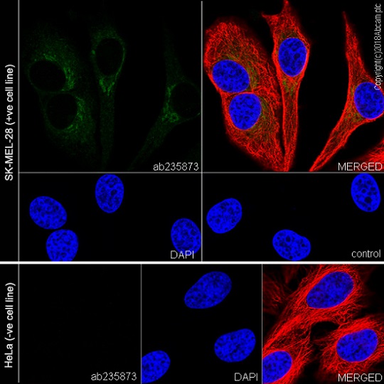 Immunocytochemistry/ Immunofluorescence - Anti-GPNMB antibody [EPR22011-47] - BSA and Azide free (AB236211), expandable thumbnail