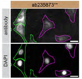 Immunocytochemistry/ Immunofluorescence - Anti-GPNMB antibody [EPR22011-47] - BSA and Azide free (AB236211), expandable thumbnail