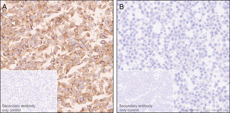 Immunohistochemistry (Formalin/PFA-fixed paraffin-embedded sections) - Anti-GPNMB antibody [EPR29063-10] (AB317325)