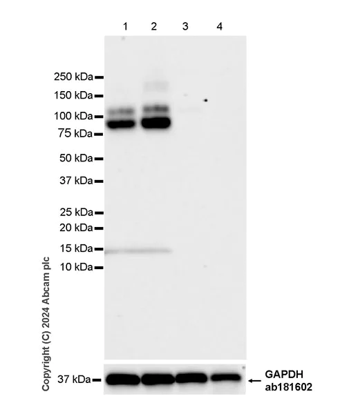 Western blot - Anti-GPNMB antibody [EPR29063-10] (AB317325)