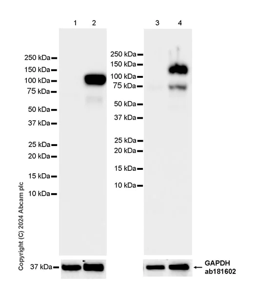 Western blot - Anti-GPNMB antibody [EPR29063-10] (AB317325)