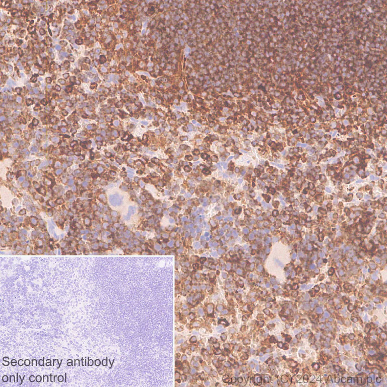 Immunohistochemistry (Formalin/PFA-fixed paraffin-embedded sections) - Anti-GPNMB antibody [EPR29063-10] - BSA and Azide free (AB317326)