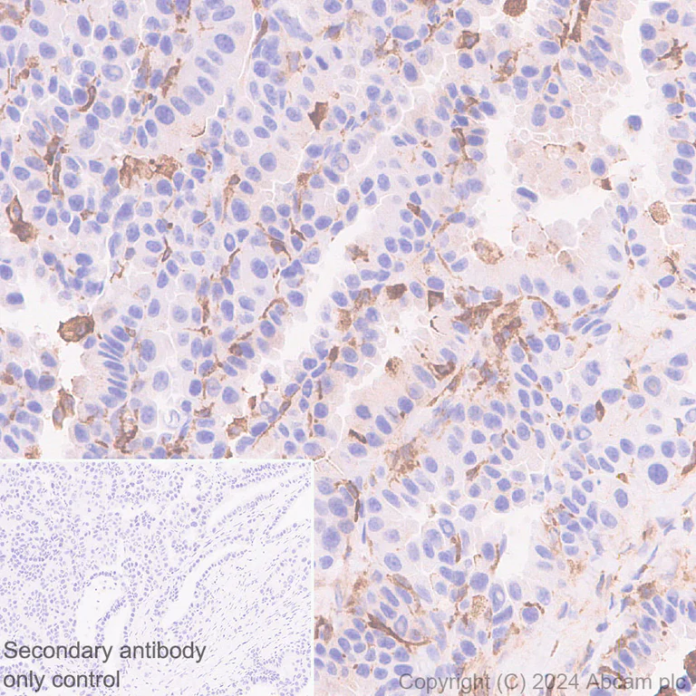 Immunohistochemistry (Formalin/PFA-fixed paraffin-embedded sections) - Anti-GPNMB antibody [EPR29063-10] - BSA and Azide free (AB317326)