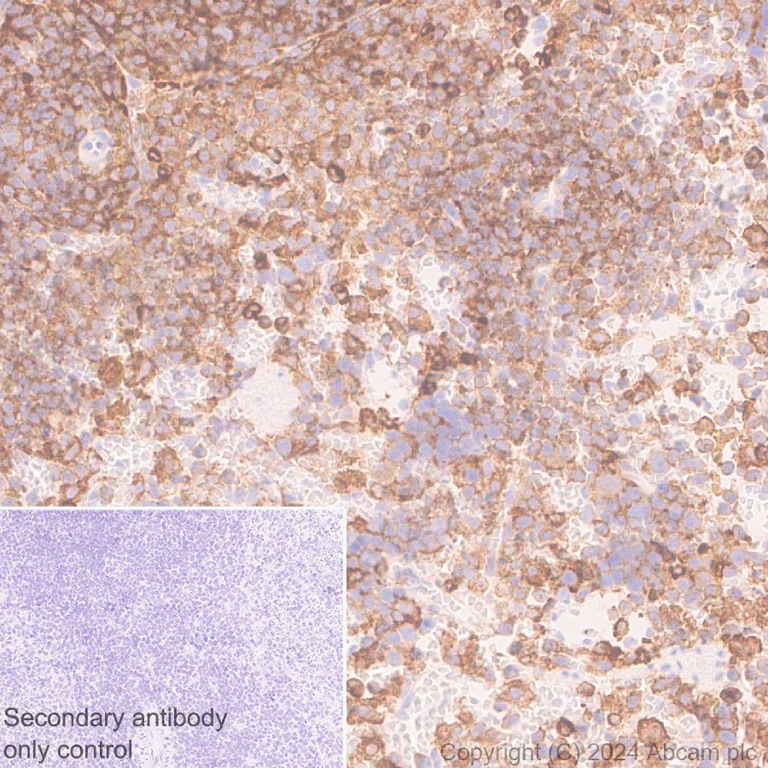 Immunohistochemistry (Formalin/PFA-fixed paraffin-embedded sections) - Anti-GPNMB antibody [EPR29063-10] - BSA and Azide free (AB317326)