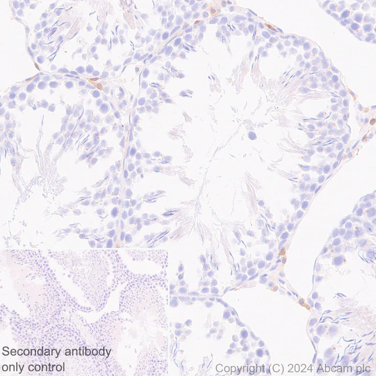Immunohistochemistry (Formalin/PFA-fixed paraffin-embedded sections) - Anti-GPNMB antibody [EPR29063-10] - BSA and Azide free (AB317326)
