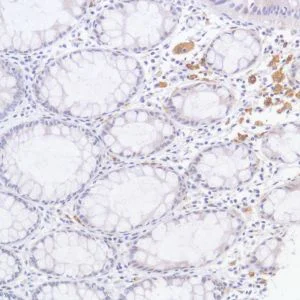 Immunohistochemistry (Formalin/PFA-fixed paraffin-embedded sections) - Anti-GPNMB antibody [SP299] (AB227695)